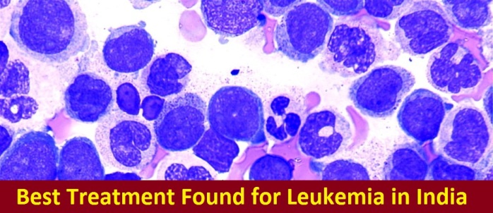 acute-myeloid-leukemia
